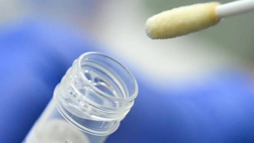 Ein-Tupfer-mit-einem-Abstrich-fuer-einen-Corona-Test