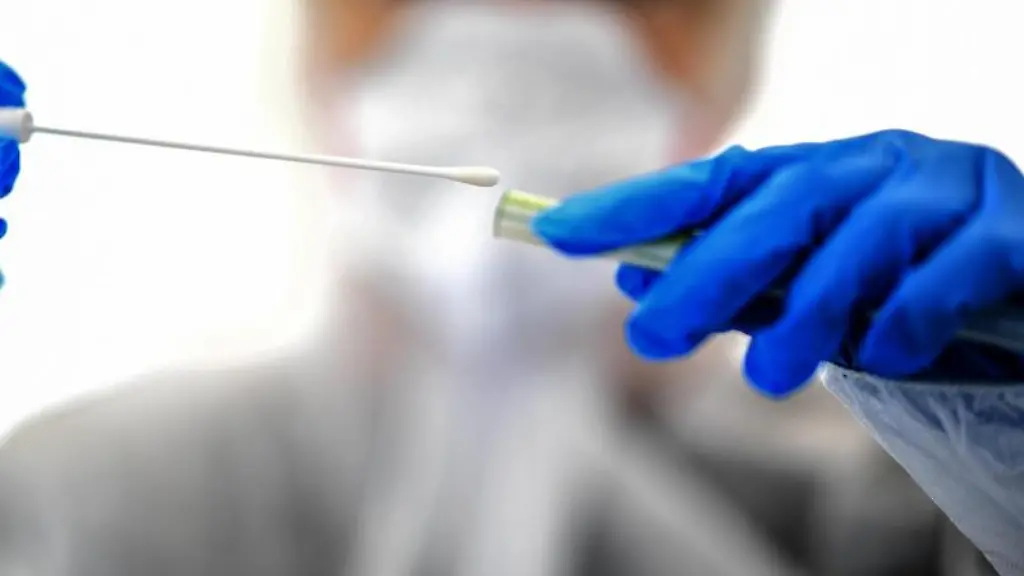 Ein-Abstrichstaebchen-wird-in-einer-ambulanten-Corona-Test-Einrichtung-fuer-die-Analyse-vorbereitet