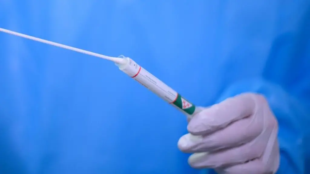 Ein-Arzt-haelt-einen-Coronavirus-Test-in-den-Haenden