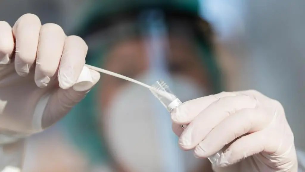 Ein-medizinischer-Mitarbeiter-haelt-einen-Tupfer-mit-einem-Abstrich-fuer-eine-Corona-Test-in-der-Hand