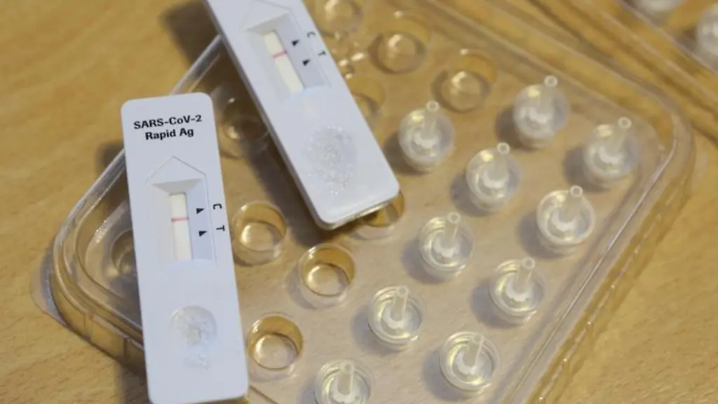 Corona-Schnelltests-liegen-in-einem-Testzentrum-auf-einem-Tisch