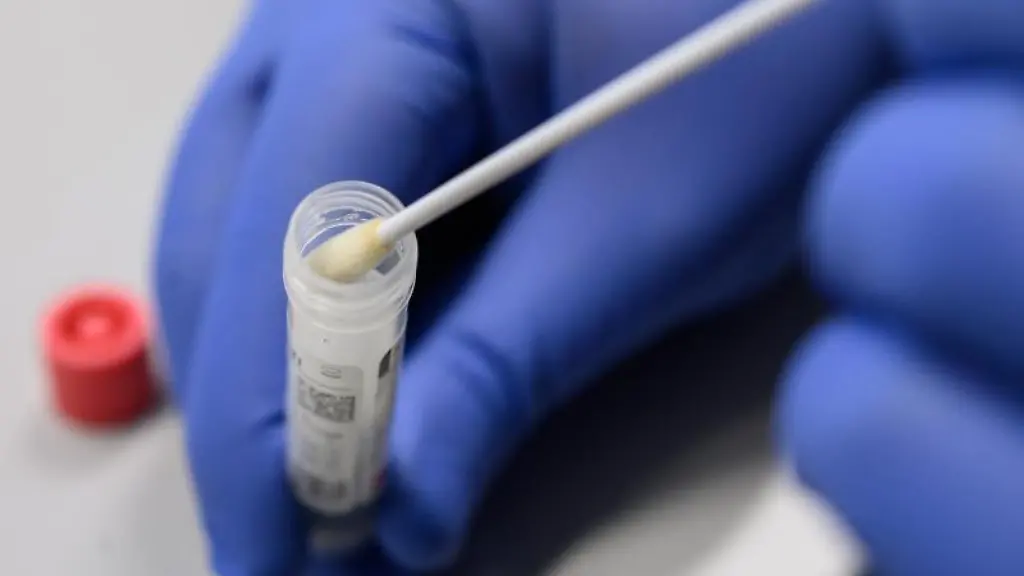 Ein-Mann-zeigt-einen-Abstrich-fuer-das-Testverfahren-auf-das-Virus-Sars-CoV-2