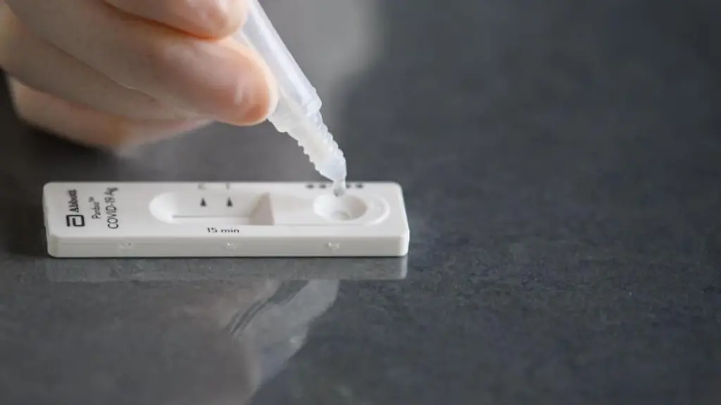 Eine-Loesung-wird-auf-eine-Testkassette-eines-Corona-Schnelltests-aufgetraeufelt