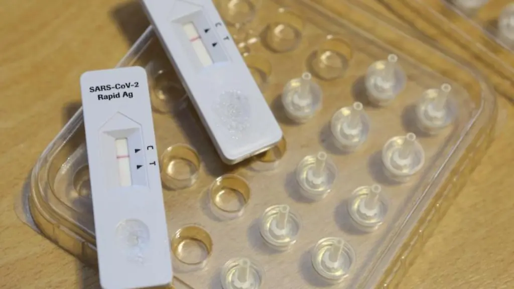 Corona-Schnelltests-liegen-in-einem-Testzentrum