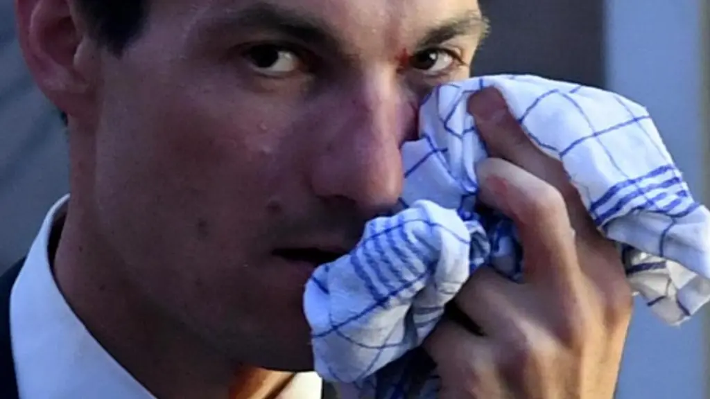 Der-Freiburger-Oberbuergermeister-Martin-Horn-haelt-sich-nach-einer-Attacke-einen-Eisbeutel-an-das-Gesicht