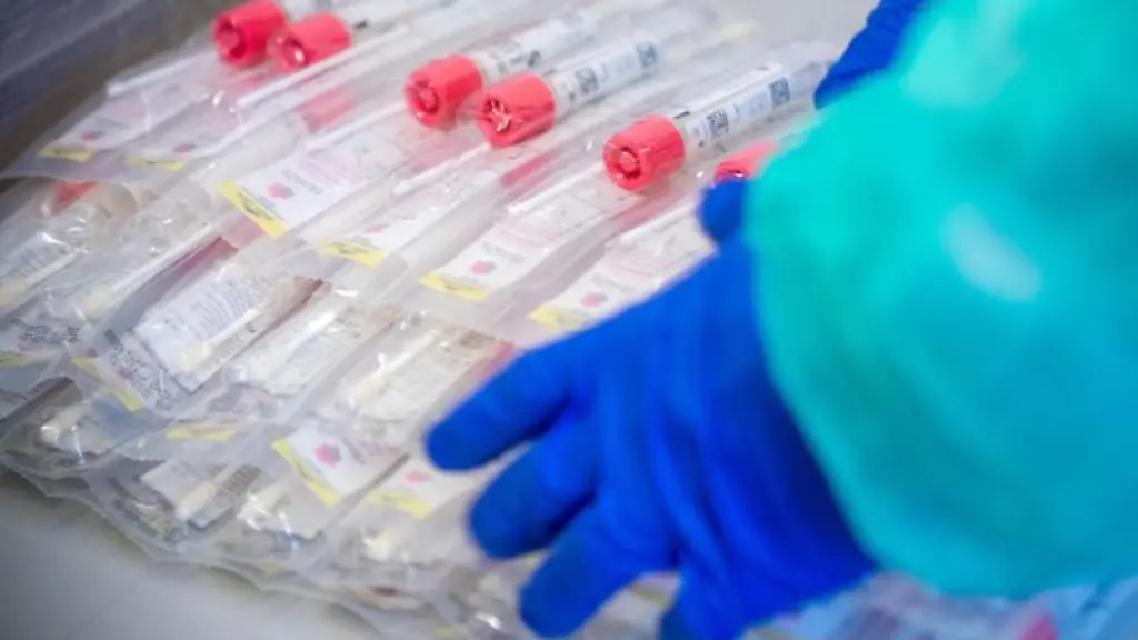 Testsets-mit-Abstrichstaebchen-liegen-in-einem-Testzentrum-fuer-Corona-Verdachtsfaelle