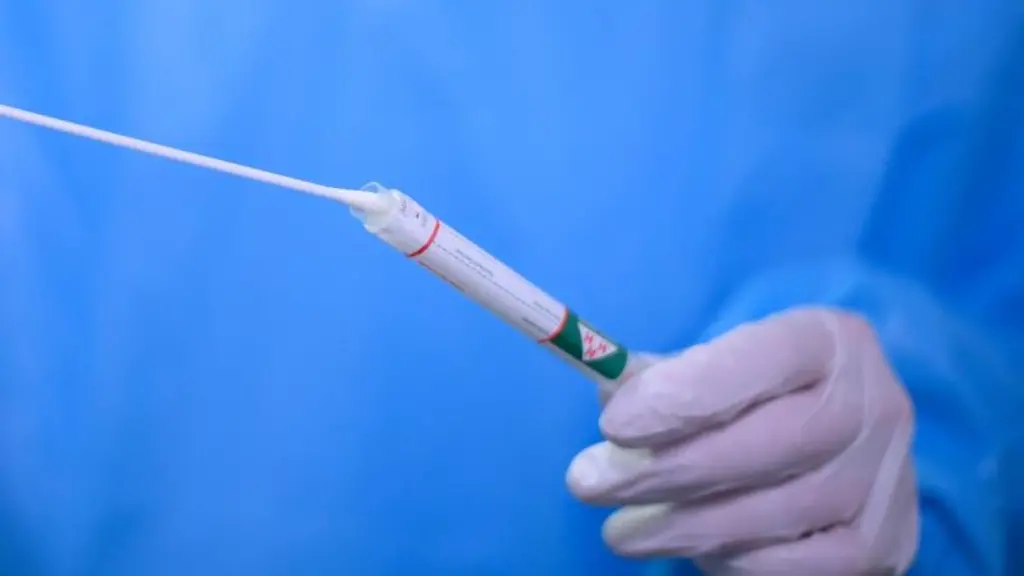 Ein-Arzt-haelt-einen-Coronavirus-Test-in-den-Haenden