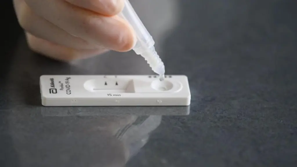 Eine-Loesung-wird-auf-eine-Testkassette-eines-Corona-Schnelltests-aufgetraeufelt