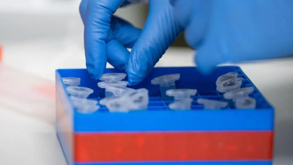 Eine-Laborantin-sortiert-Proben