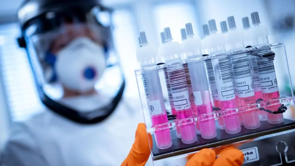 Eine-wissenschaftliche-Mitarbeiterin-haelt-Coronavirus-Testproben-in-der-Hand