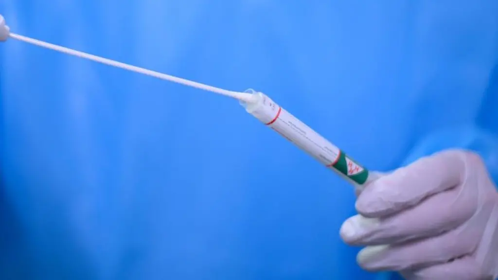 Ein-Arzt-haelt-einen-Coronavirus-Test-in-den-Haenden