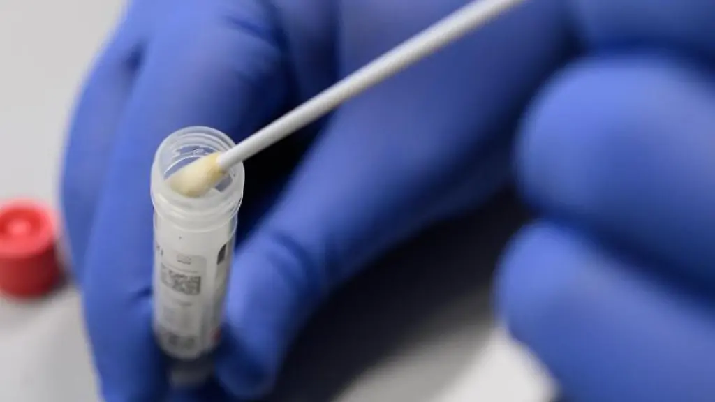 Ein-Mann-zeigt-einen-Abstrich-fuer-das-Testverfahren-auf-das-Virus-Sars-CoV-2