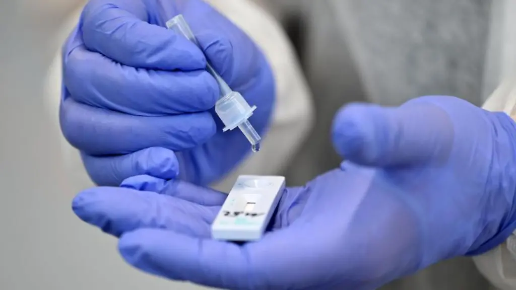 Ein-Helfer-verarbeitet-eine-Probe-fuer-einen-Corona-Schnelltest