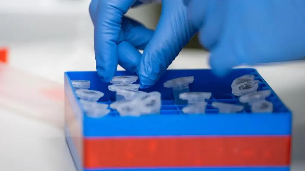 Eine-Laborantin-sortiert-Proben