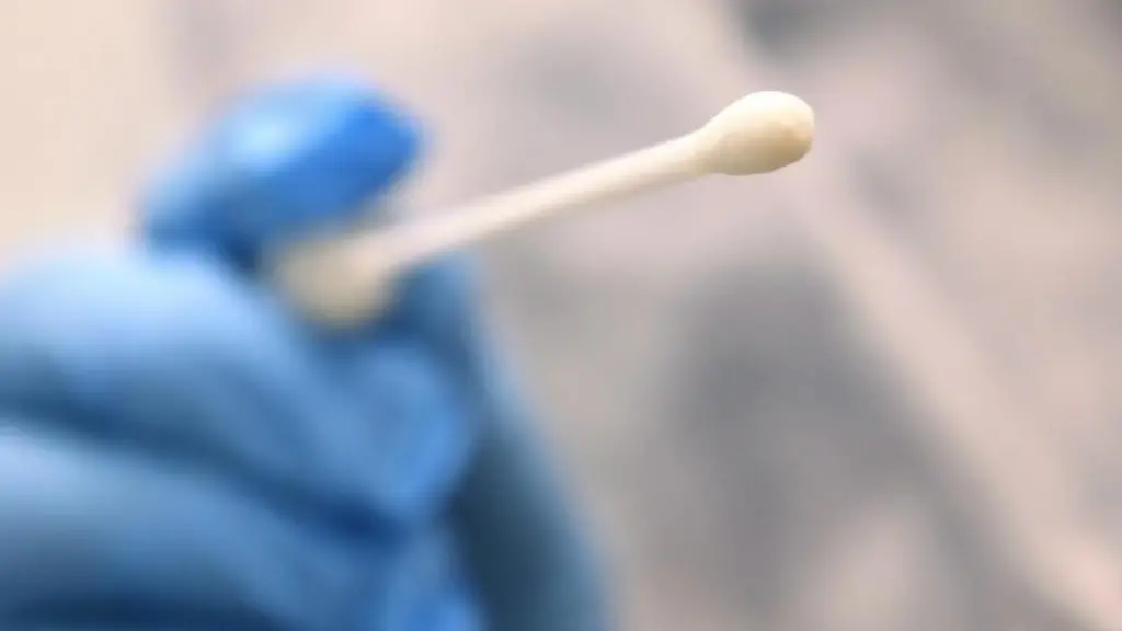 Ein-Arzt-haelt-einen-Tupfer-mit-dem-ein-Abstrich-fuer-einen-Coronatest-gemacht-wird