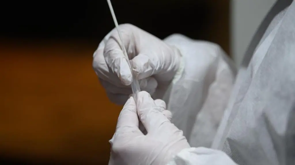 Ein-Corona-Schnelltest-wird-in-einer-Teststation-aufbereitet