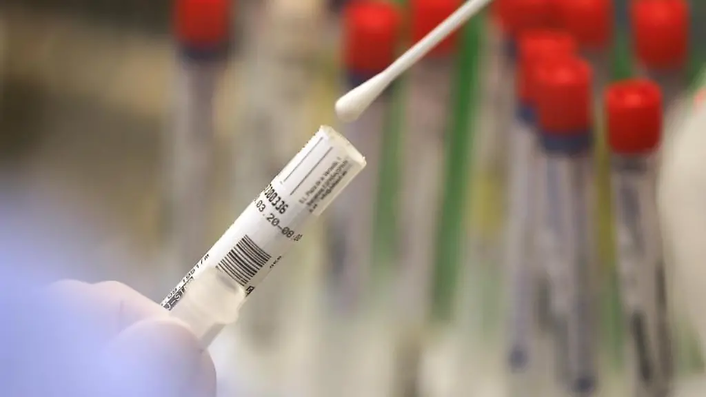 Ein-Abstrich-wird-in-einem-Labor-auf-das-Coronavirus-untersucht
