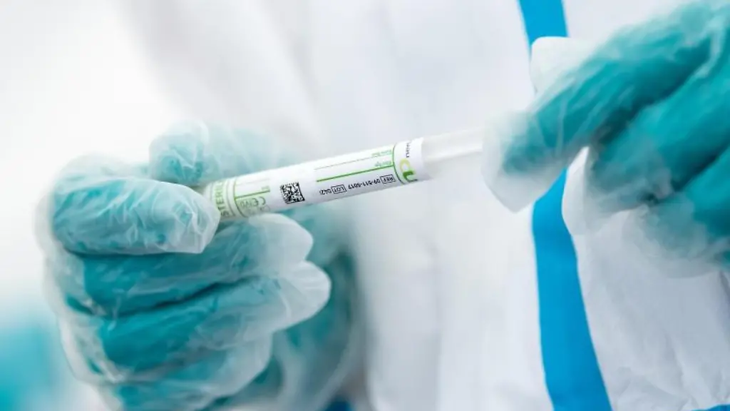 Ein-medizinischer-Mitarbeiter-haelt-ein-Testroehrchen-in-den-Haenden