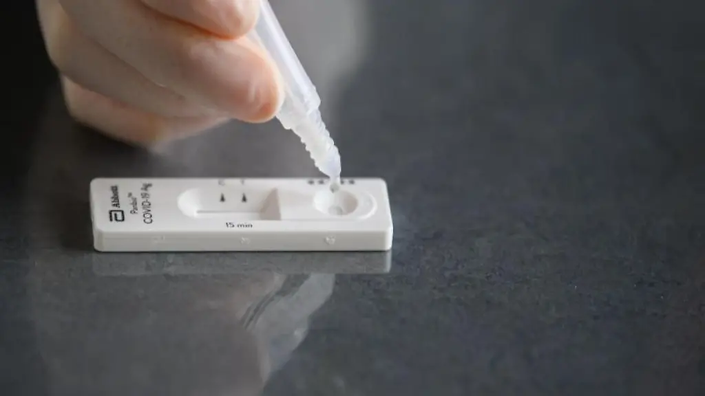 Eine-Loesung-wird-auf-eine-Testkassette-eines-Corona-Schnelltests-aufgetraeufelt