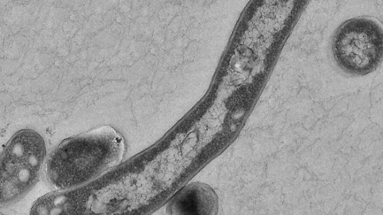 Tuberkulose-Erreger unter dem Elektronenmikroskop: Trotz rückläufiger Zahlen gibt es auch in Deutschland keinen Grund zur Entwarnung.