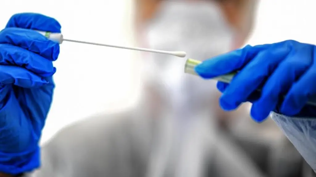 Ein-Abstrichstaebchen-wird-in-einer-ambulanten-Corona-Test-Einrichtung-fuer-die-Analyse-vorbereitet