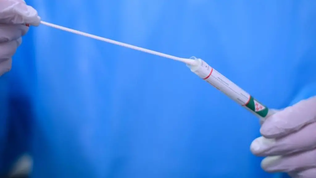 Ein-Arzt-haelt-einen-Coronavirus-Test-in-den-Haenden