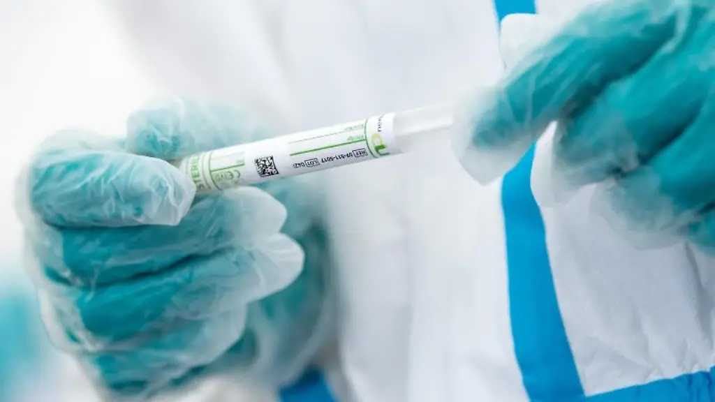 Ein-Mitarbeiter-haelt-ein-Corona-Testroehrchen-in-den-Haenden