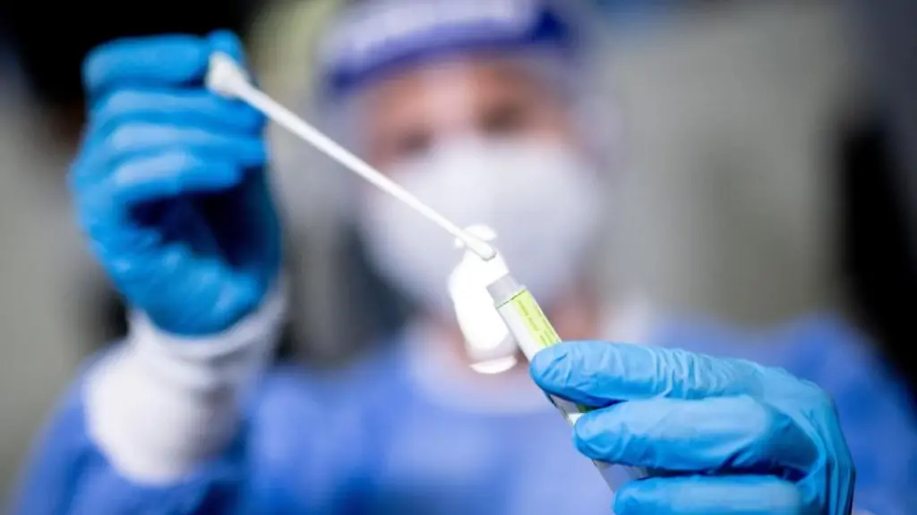 Eine-medizinische-Mitarbeiterin-haelt-einen-Tupfer-mit-einem-Abstrich-fuer-einen-Corona-Test-in-der-Hand