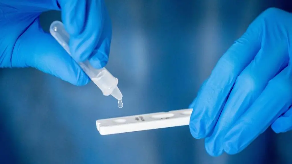 Medizinisch-geschultes-Personal-fuehrt-einen-Corona-Schnelltest-durch