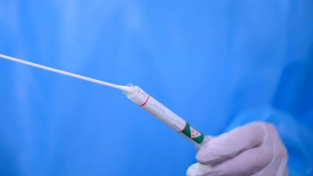 Ein-Arzt-haelt-einen-Coronavirus-Test-in-den-Haenden