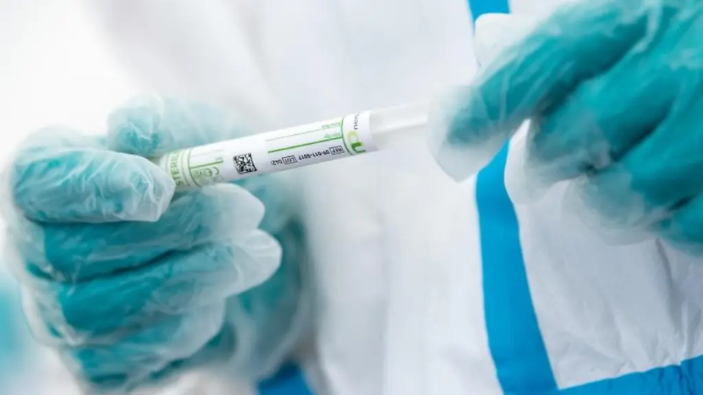 Ein-Mitarbeiter-haelt-ein-Corona-Testroehrchen-in-den-Haenden