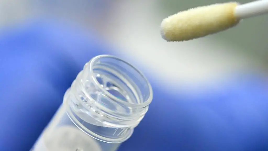 Ein-Tupfer-mit-einem-Abstrich-fuer-einen-Corona-Test