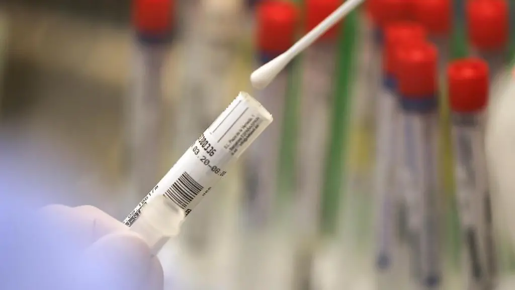 Ein-Abstrich-wird-in-einem-Labor-auf-das-Coronavirus-untersucht