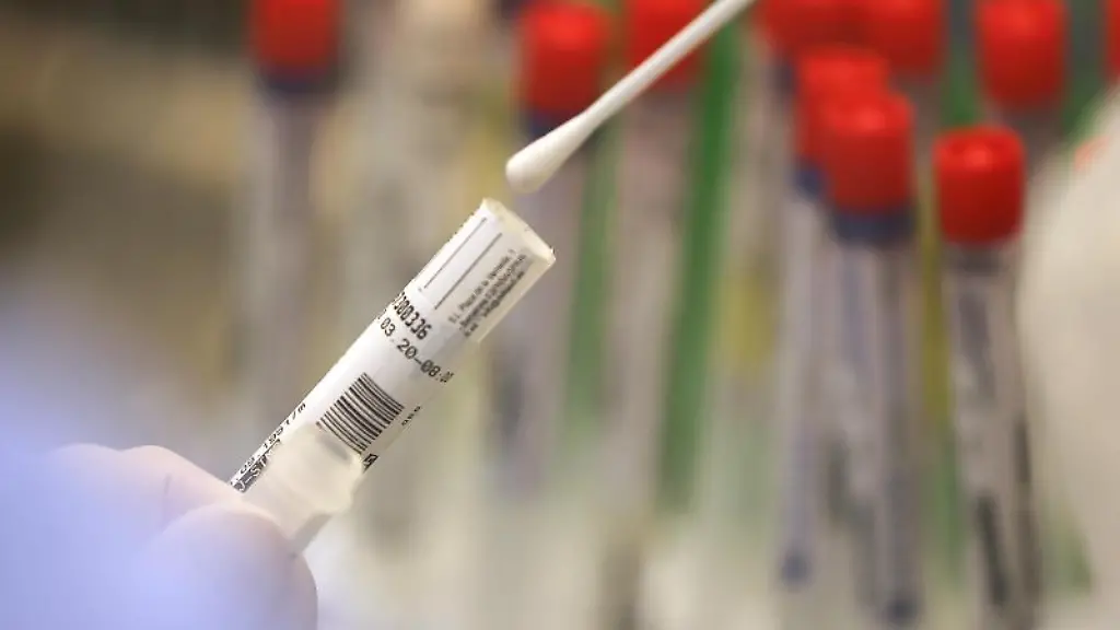 Ein-Abstrich-wird-in-einem-Labor-auf-das-Coronavirus-untersucht