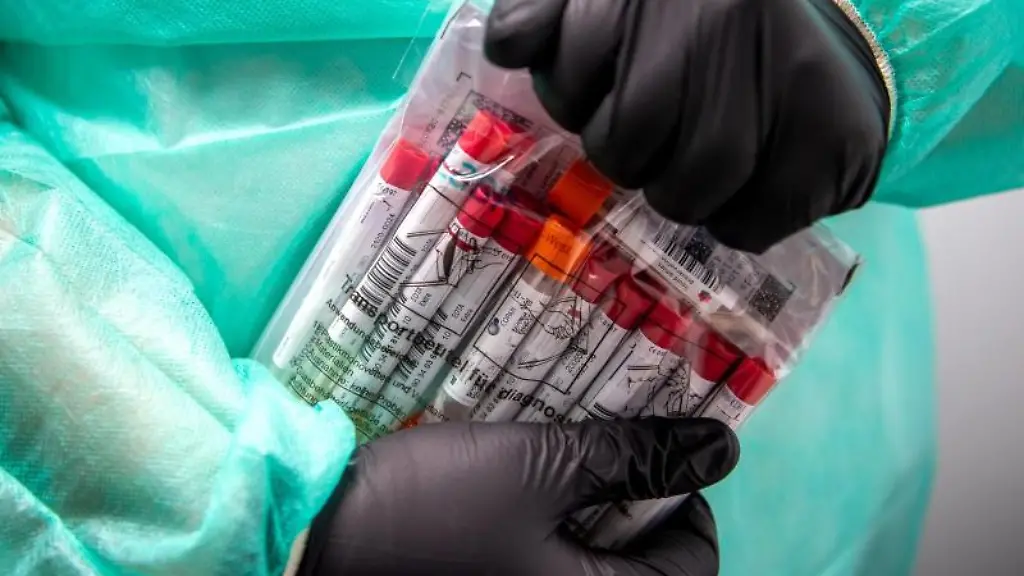 Proben-fuer-einen-PCR-Test-werden-von-einem-Laboranten-verpackt