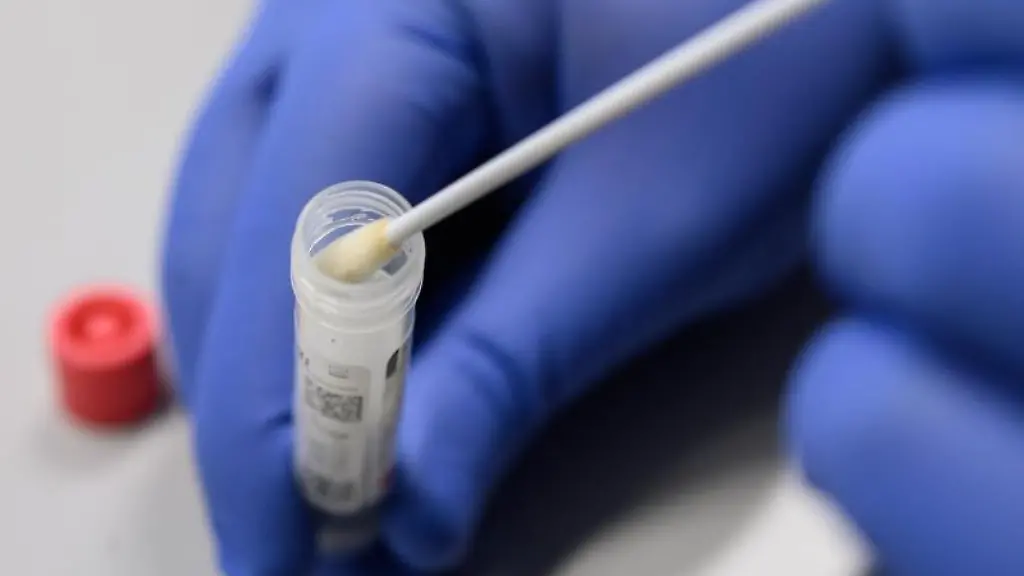 Ein-Mann-zeigt-einen-Abstrich-fuer-das-Testverfahren-auf-das-Virus-Sars-CoV-2