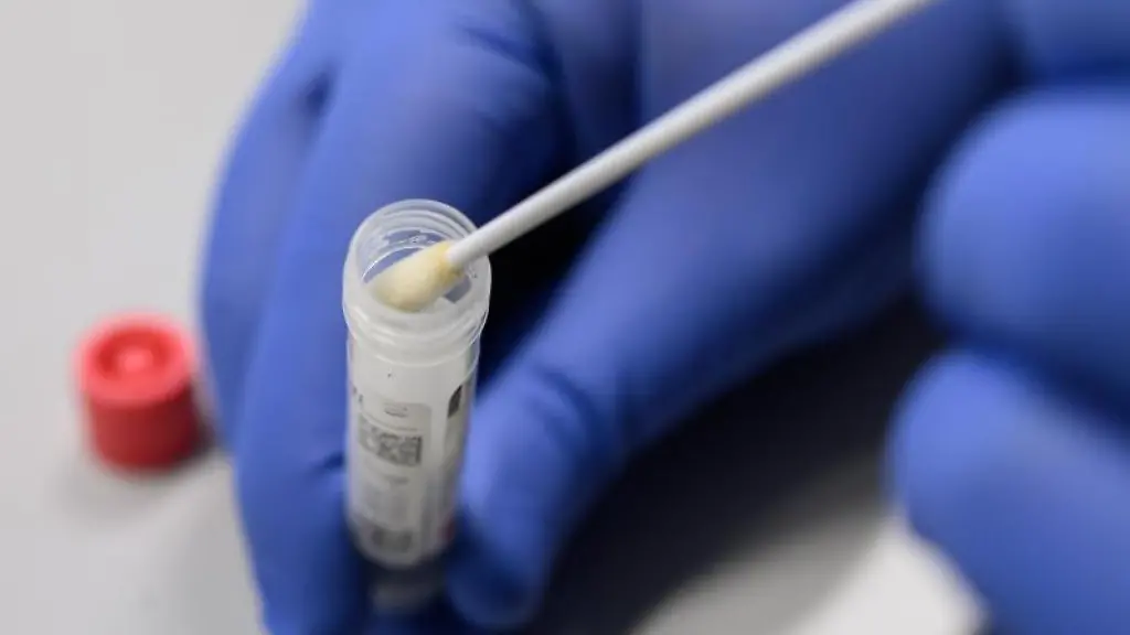 Ein-Mann-zeigt-einen-Abstrich-fuer-das-Testverfahren-auf-das-Virus-Sars-CoV-2