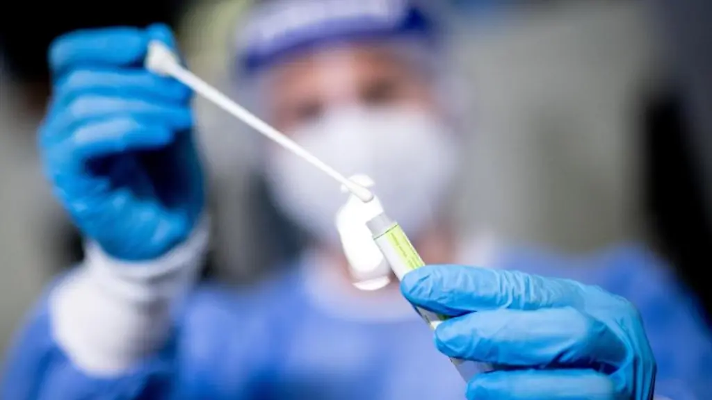 Eine-Frau-haelt-in-einem-Covid-19-Testcenter-die-Probe-von-einem-Rachenabstrich-in-den-Haenden