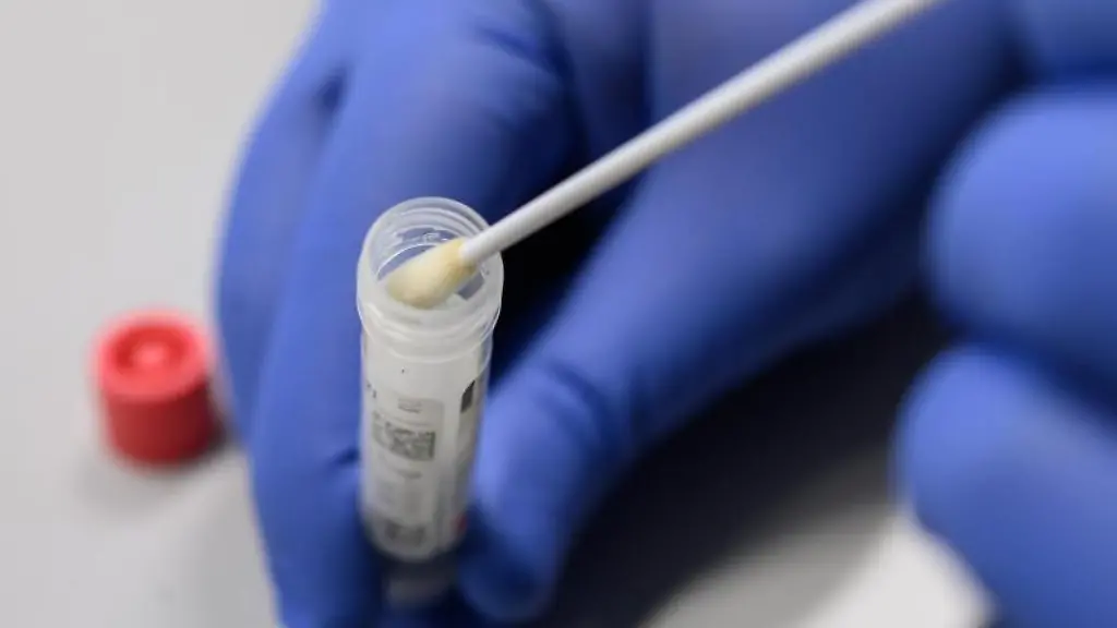 Ein-Mann-zeigt-einen-Abstrich-fuer-das-Testverfahren-auf-das-Virus-Sars-CoV-2