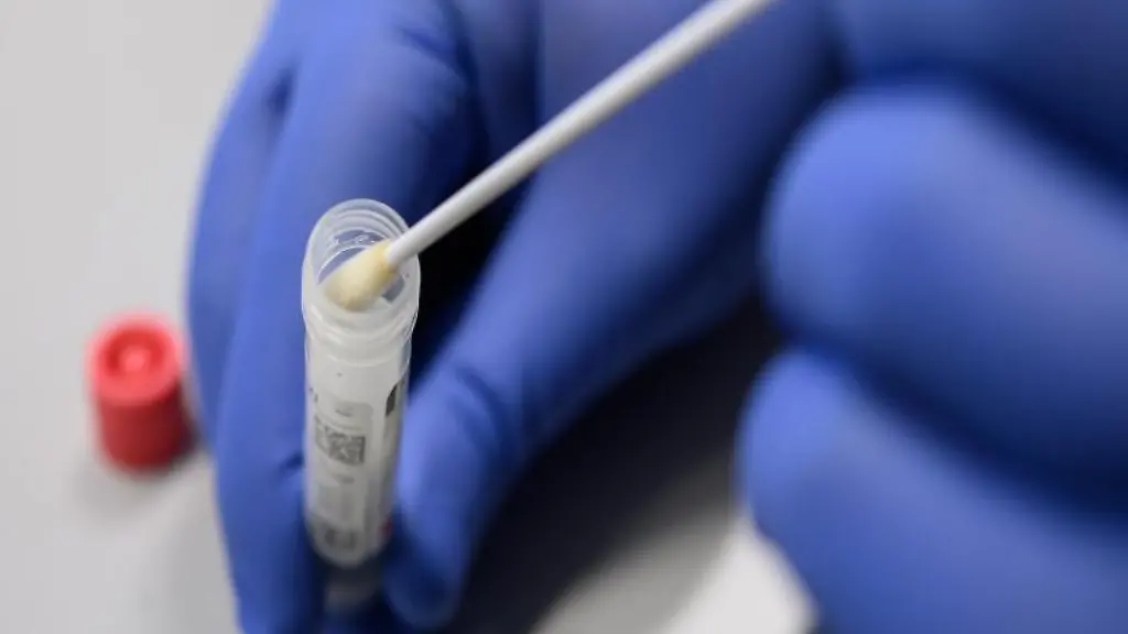 Ein-Mann-zeigt-einen-Abstrich-fuer-das-Testverfahren-auf-das-Virus-Sars-CoV-2