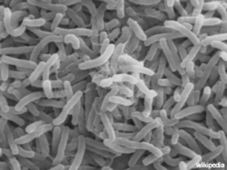 Cholera-Bakterien im Sekundärelektronenmikroskop.