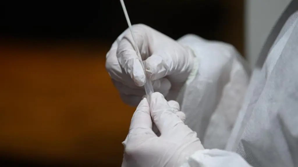 Ein-medizinischer-Mitarbeiter-bereitet-einen-Tupfer-fuer-einen-Abstrich-fuer-einen-Corona-Test-vor