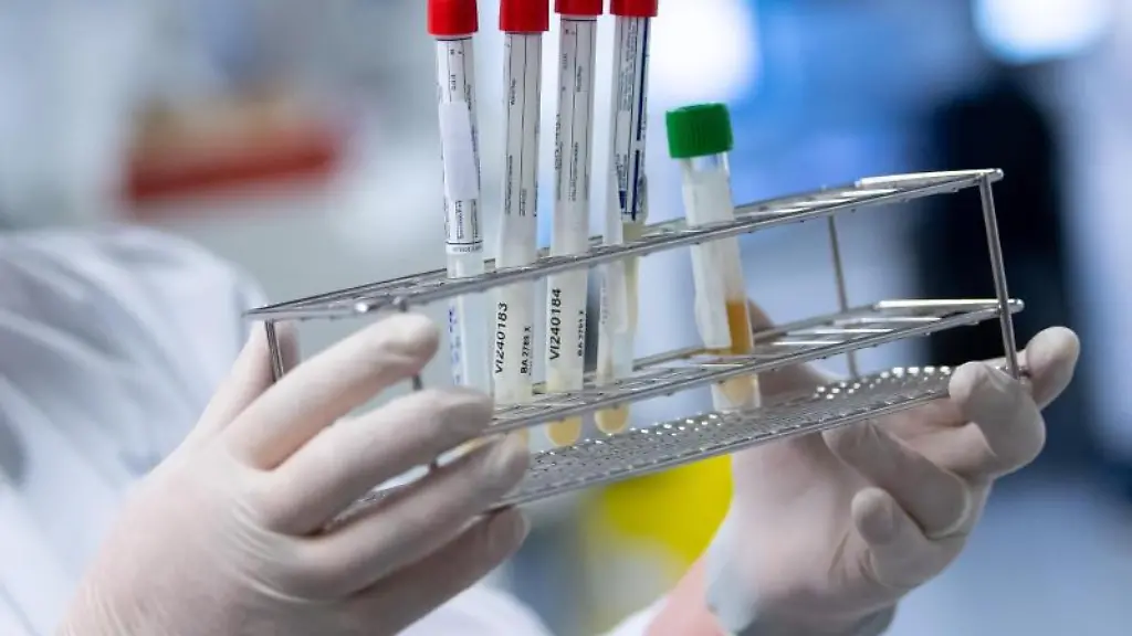 Eine-Laborantin-bereitet-Corona-Proben-fuer-die-weitere-Analyse-vor