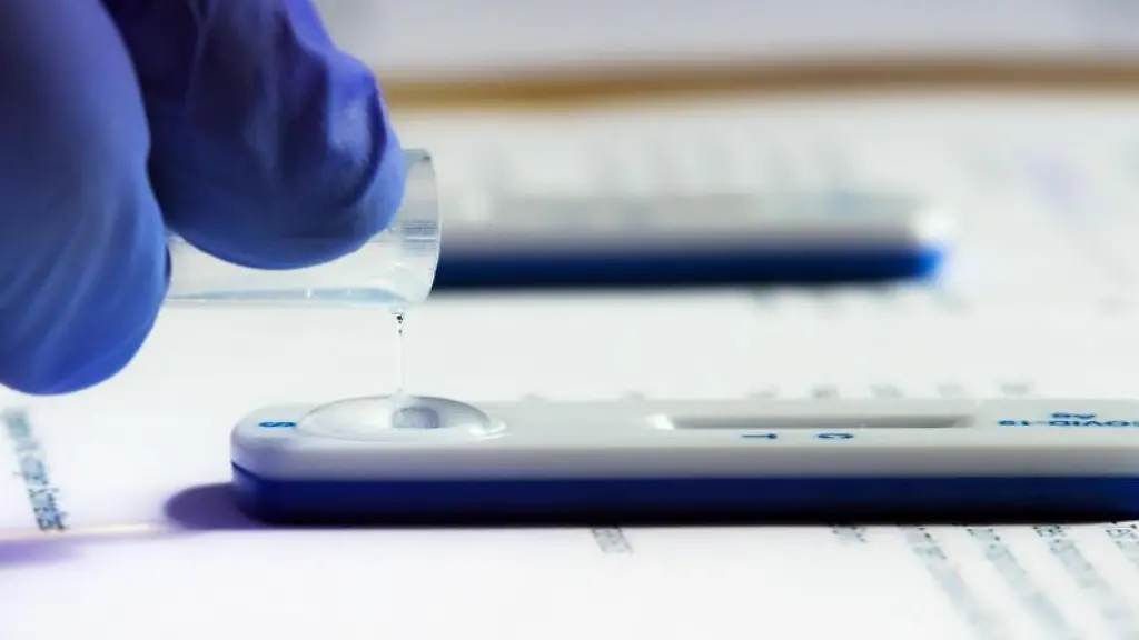 Die-Testfluessigkeit-eines-Corona-Schnelltests-wird-ausgewertet