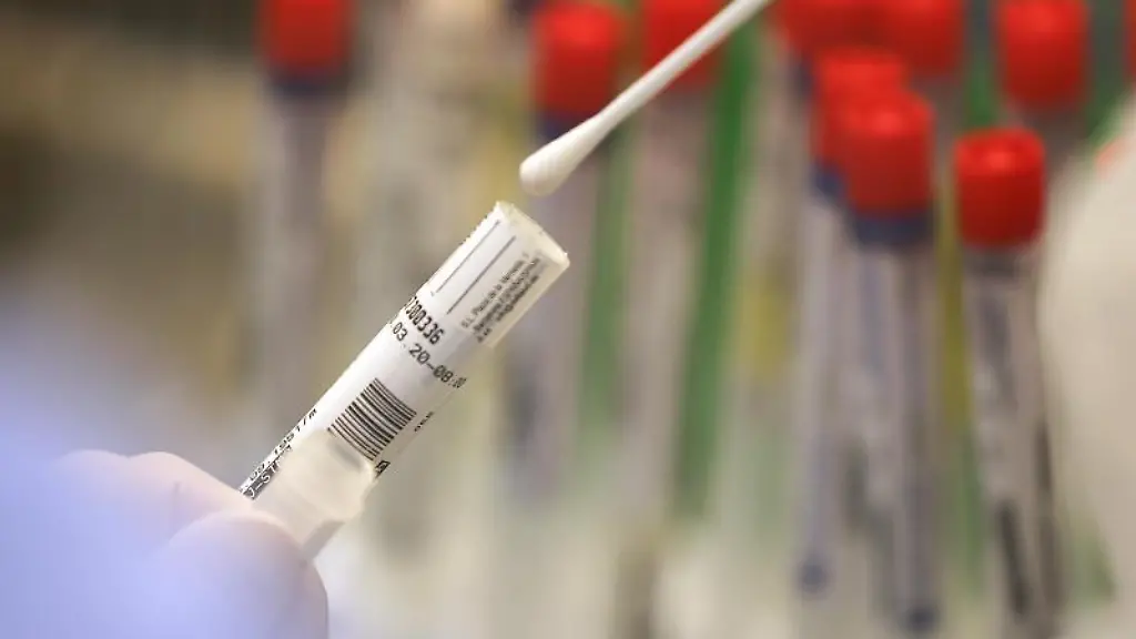 Ein-Abstrich-wird-in-einem-Labor-auf-das-Coronavirus-untersucht