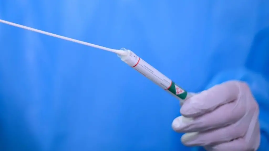 Ein-Arzt-steckt-einen-Tupfer-mit-einem-Abstrich-fuer-einen-Corona-Test-in-ein-Testroehrchen