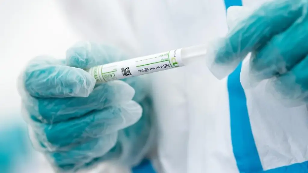 Ein-medizinischer-Mitarbeiter-haelt-ein-Testroehrchen-in-den-Haenden