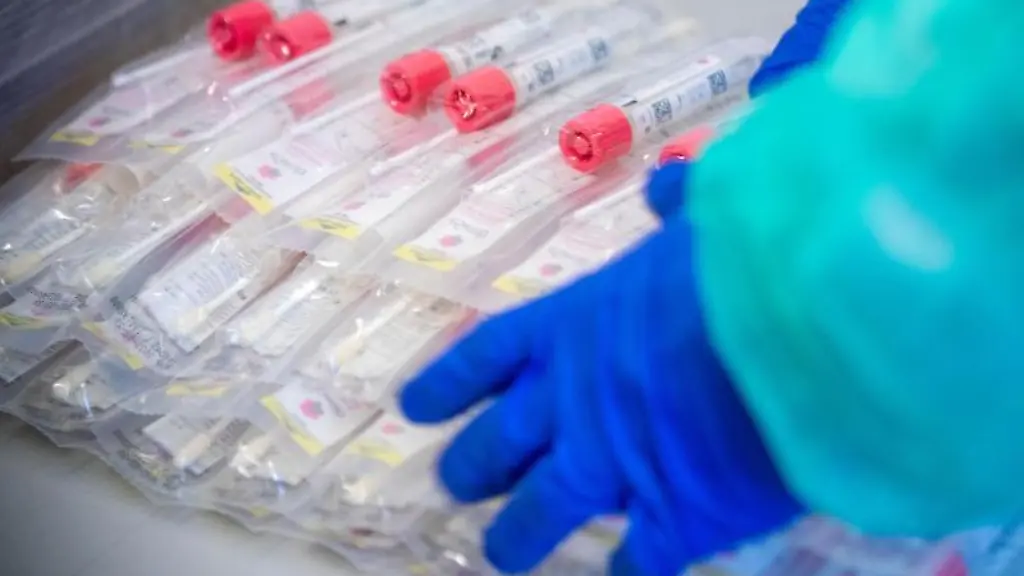 Testsets-mit-Abstrichstaebchen-liegen-in-einem-Corona-Testzentrum