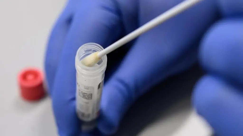 Ein-Mann-zeigt-einen-Abstrich-fuer-das-Testverfahren-auf-das-Virus-Sars-CoV-2