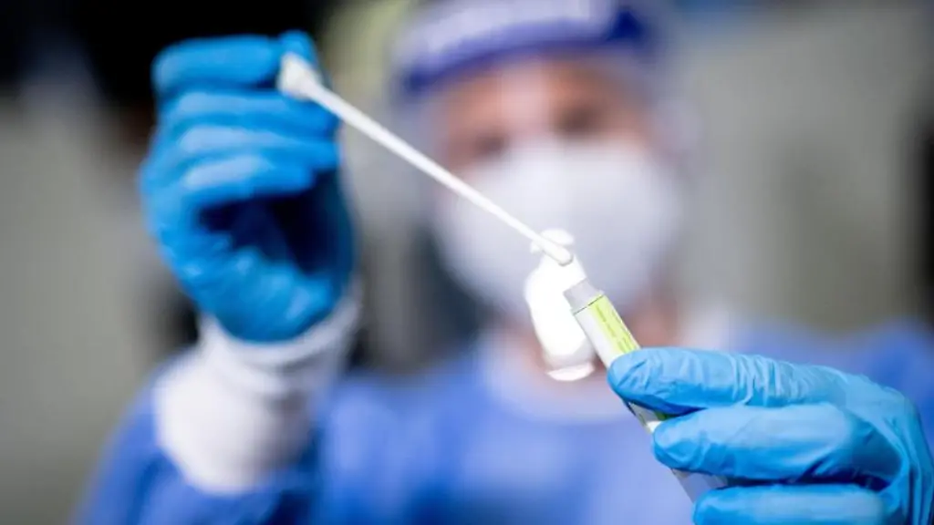 Eine-Frau-haelt-in-einem-Covid-19-Testcenter-die-Probe-von-einem-Rachenabstrich-in-den-Haenden
